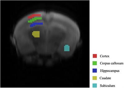 Comparisons of Glutamate in the Brains of Alzheimer’s Disease Mice Under Chemical Exchange Saturation Transfer Imaging Based on Machine Learning Analysis